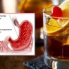 Uticaj alkohola na stomak, pijući alkohol tokom gastritisa