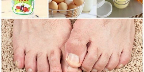 Funding gljivice na nogama sa sirćetom i jajetom