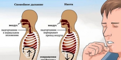 Metode da se riješim ikota nakon uzimanja alkohola