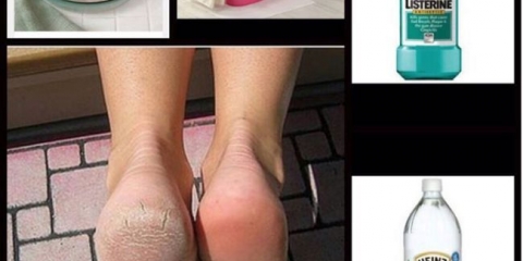 Znači za pete iz glicerola, sirćeta