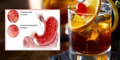 Uticaj alkohola na stomak, pijući alkohol tokom gastritisa